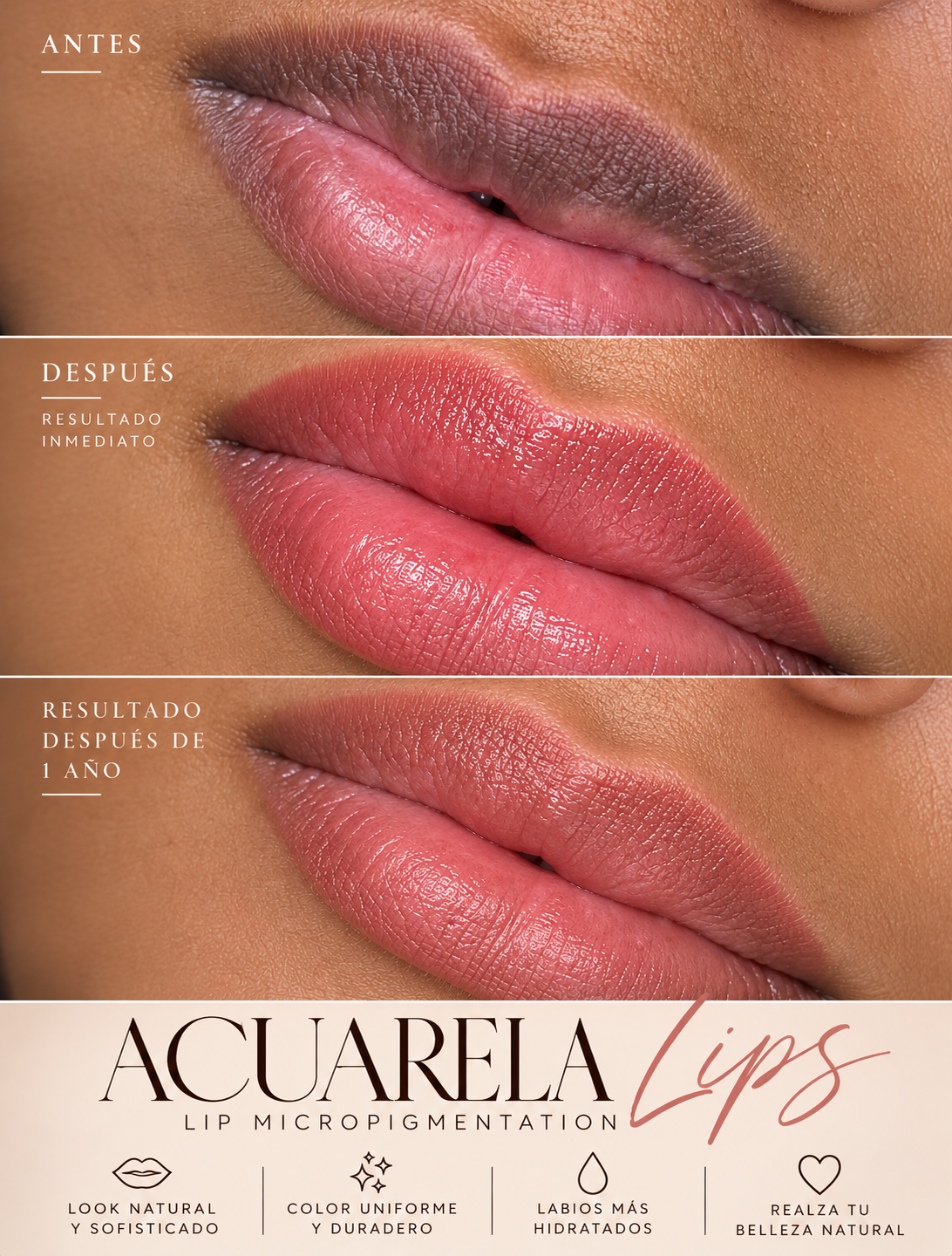 Lip Micropigmentation