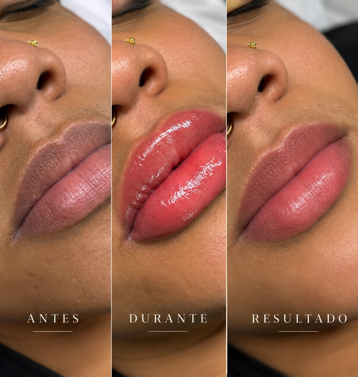 Lip Micropigmentation