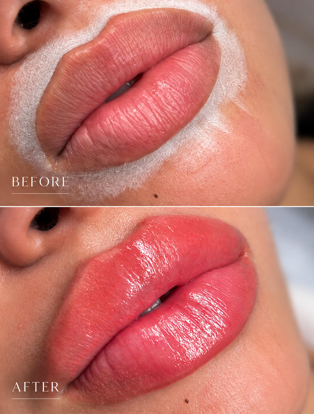 Lip Micropigmentation